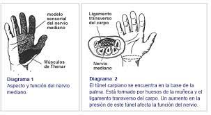 Sindrome Del Tunel Carpiano Clinica Las Condes