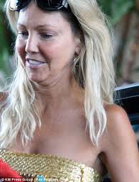 What happened to Heather Locklear's face? Actress visibly ages in just a  few months