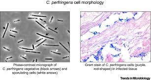 Image result for Clostridium