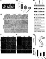 Pilote d'installation canon adv c250i / canon imagerunner advance 4035i. Acridine Yellow G Blocks Glioblastoma Growth Via Dual Inhibition Of Epidermal Growth Factor Receptor And Protein Kinase C Kinases Journal Of Biological Chemistry