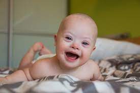 Download down syndrome baby stock photos. Expecting A Baby With Down Syndrome The Pulse