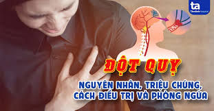 Mỗi năm ở việt nam có hơn 200.000 người bị đột quỵ, hơn 50% trong số đó tử vong và chỉ có 10% sống sót là có bình phục hoàn toàn. Ä'á»™t Quá»µ Nguyen Nhan Triá»‡u Chá»©ng Cach Ä'iá»u Trá»‹ Va Phong Ngá»«a