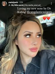 Rhinoplasty in Los Angeles