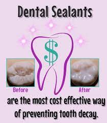 Dental Sealants Save Money Dental Sealants Dental Insurance Plans Sealant