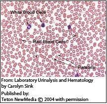 Autoimmune Hemolytic Anemia In Dogs Pet Resources Bishop Ranch Veterinary Center Urgent Care