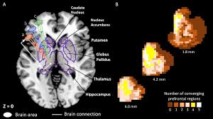 Image result for Cerebral Subcortex