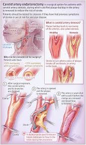 Pin On Patient Information Pages