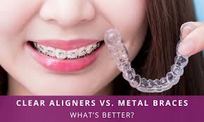 Clear Aligners Vs. Metal Braces – What's Better? – Richardson's Plastic  Surgery Hospitals