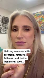 I have a dermatologist friend who has a hard timekeeping her mouth shut  when she sees people with cancers