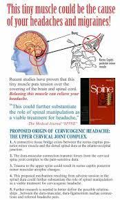 Cervicogenic Headache Exercises Google Search Headache Neck Headache Migraine Headaches