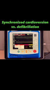 Image result for Synchronized Cardioversion