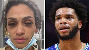 NBA news: Miles Bridges' wife shares photos of alleged domestic abuse,  Mychelle Johnson, Charlotte Hornets
