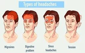 Image result for Headache Self-Help Measure