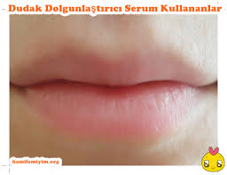 Dudaklarim Cok Ince Dudak Dolgusu Fiyatlari Nedir Kadinlar Kulubu Forum