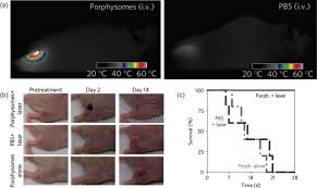 Image result for Porfimer