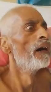 Maggots wriggle in mouth of man as he recovers in hospital from leg injury 