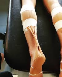 Image result for Taping for Soleus and Achilles