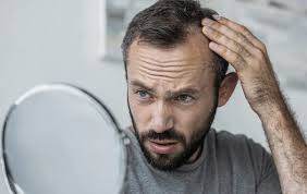 The types of hair loss most related to stress are: Can Stress Cause Hair Loss We Asked An Expert To Explain The Irish News
