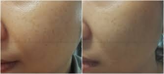 After using kiehl's products on and off for the past 2 years, i'm here to update you guys with my current skin. Carolyn S Lavender Garden Comparison Review Kiehl S Clearly Corrective Dark Spot Solution Cosrx Mela14 White Ampule