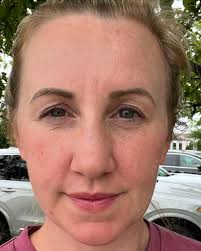 Danielle Ingram • OP Esthetician (@skin.with.d) • Instagram photos and  videos