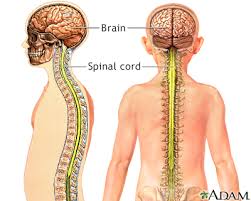 Image result for Syringomyelia