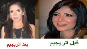 We did not find results for: Ù„Ù† ØªØµØ¯Ù‚ ÙƒÙŠÙ ØªØºÙŠØ± Ø´ÙƒÙ„ Ø§Ù„Ù†Ø¬Ù…Ø© Ù…Ù†Ù‰ Ø²ÙƒÙ‰ Ø¨Ø¹Ø¯ Ø§Ù„Ø±ÙŠØ¬ÙŠÙ… Ø§Ù„Ù‚Ø§Ø³Ù‰ Ø§Ù„Ø°Ù‰ Ø¥ØªØ¨Ø¹ØªÙ‡ Youtube
