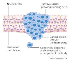 How long does it take for cancer to spread. How Cancer Can Spread Cancer Research Uk
