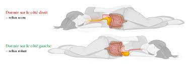 La position sur le côté gauche est déconseillée pour les adultes, le cœur peut se fatiguer avec le poids des autres organes. Le Rgo Vous Empeche T Il De Dormir Societe Gastro Intestinale Www Mauxdeventre Org