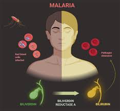 Image result for Malaria