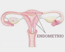 Endometriosis can also develop after menopause but it is rare and could be associated with the use of: Diagnosi E Cura Dell Endometriosi Seno Clinic