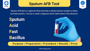 Image result for Sputum