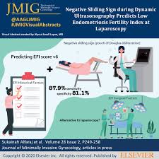 Pathophysiology to practice, a module fully funded by an unrestricted educational grant from abbott laboratories, reviews the current evidence and practical clinical experience for the evaluation and treatment of endometriosis. Jmig On Twitter This Study Showed That A Negative Sliding Sign Plus Endometriosis Fertility Index Historical Factors Can Predict An Efi Score 6 Ultrasound May Be An Alternative To Surgery In Predicting
