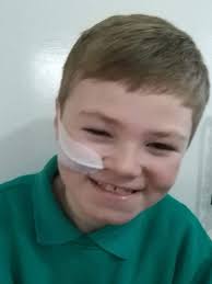 Teambraxy update: Updates are much harder these days because to be honest  Braxton is not doing well. He is getting very weak and his short term  memory is getting worse. His trademark