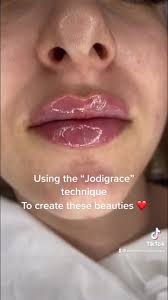 “M” shaped lips , In my opinion...