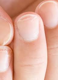 Primark has become one of the most popular brands in the united kingdom. Fingernagel Diese Veranderungen Konnen Auf Krankheiten Hindeuten