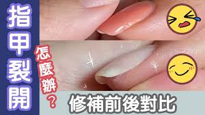 指甲裂開了怎麼辦 用凝膠指甲修補損傷指甲 前後對比與解說 damaged nails my nails nails