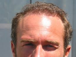 Balding can be especially difficult for men who like having long hair, and that is why they sometimes have a hard time finding the right hairstyle to hide balding long hair. Balding Man Hairstyles Awesome Collections Design Press