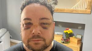 Carcharu dyn am naw mlynedd am ymosod ar heddwas