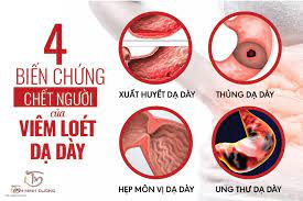 We did not find results for: Viem Loet Dáº¡ Day Ta Trang La Gi Nguyen Nhan Cach Chá»¯a 2021 Yasuni Transparente