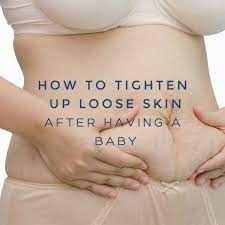 How To Tighten Loose Skin After Pregnancy