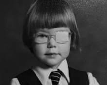 I soon as I saw Maya in the ophanage, I knew she had rickets'