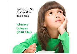 Image result for Absence Seizure