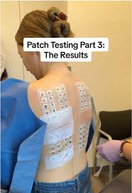 Image result for Patch Testing