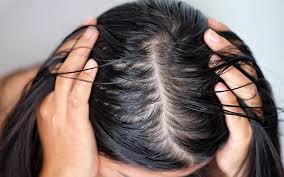 Clip, tie, or tuck the ends of your plop into the towel at the base of your neck, or wrap the arms around your head. Oily Scalp With Dry Ends Why How To Control Skinkraft