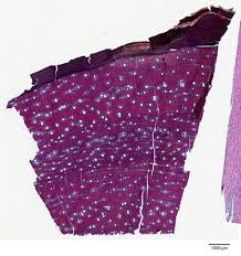 Image result for Acacia welwitschii