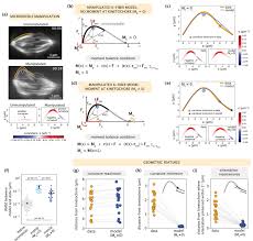 Modeling and mechanical perturbations reveal how spatially regulated  anchorage gives rise to spatially distinct mechanics across the mammalian  spindle