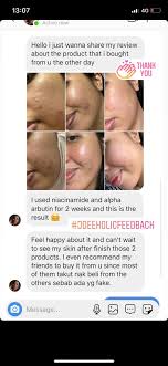 Alpha arbutin is extremely it is recommended to perform a patch test before incorporating any new product into your regimen. Jdeespree On Twitter 3 Serums The Ordinary Niacinamide The Ordinary Alpha Arbutin The Ordinary Aha Bha Peeling Solution Somebymi Aha Bha Pha 30 Days Miracle Serum Cerave Resurfacing Retinol