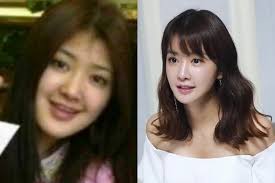 11 Artis Korea Ini Oplas Tapi Tidak Malu Untuk Mengatakannya
