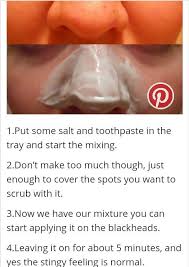 Get Rid Of Blackheads With Toothpaste And Salt How To Remove Pimples Skin Care Acne Skin Care Pimples