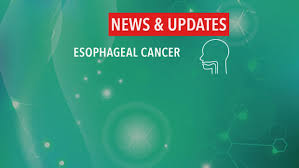 Other causes of cancer are not preventable. What Cancers Are On The Rise How We Can Stop Them In Their Tracks Cancerconnect